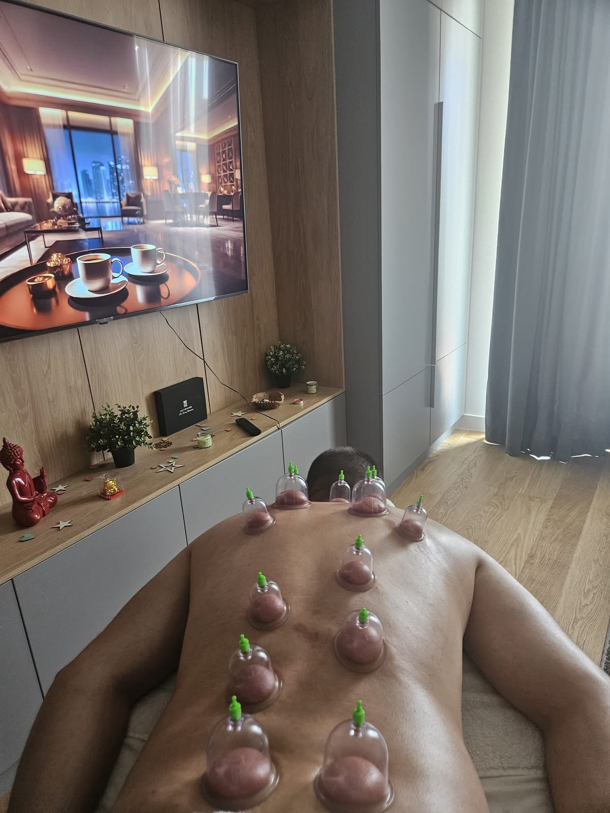 Cupping terapija na leđima